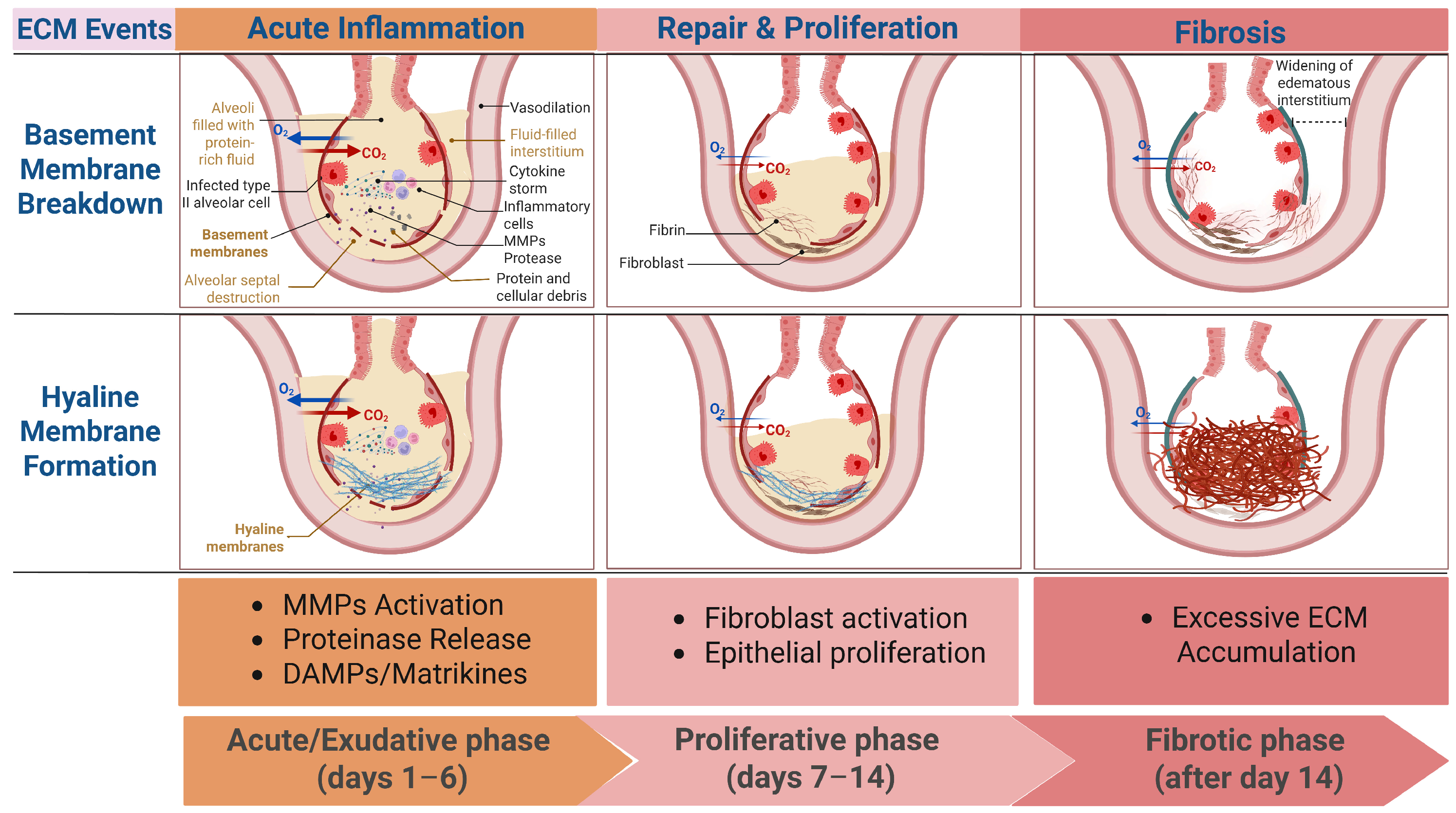 The Extracellular Matrix and the Immune System in Acute Lung Injury ...