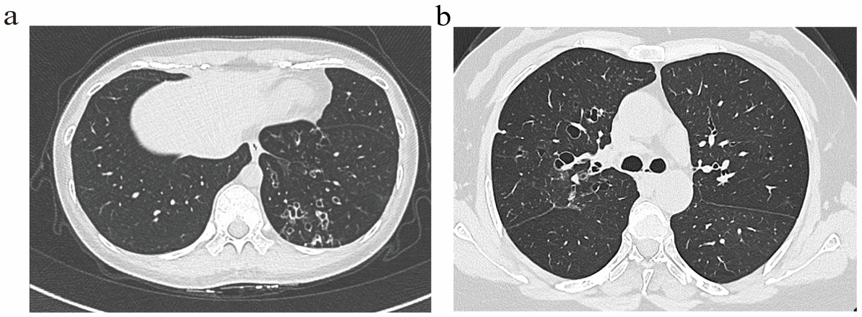 Biomedicines 14 00337 g001 Biomedicines 14 00337 g001