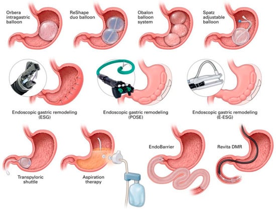 Biomedicines 14 00345 g001