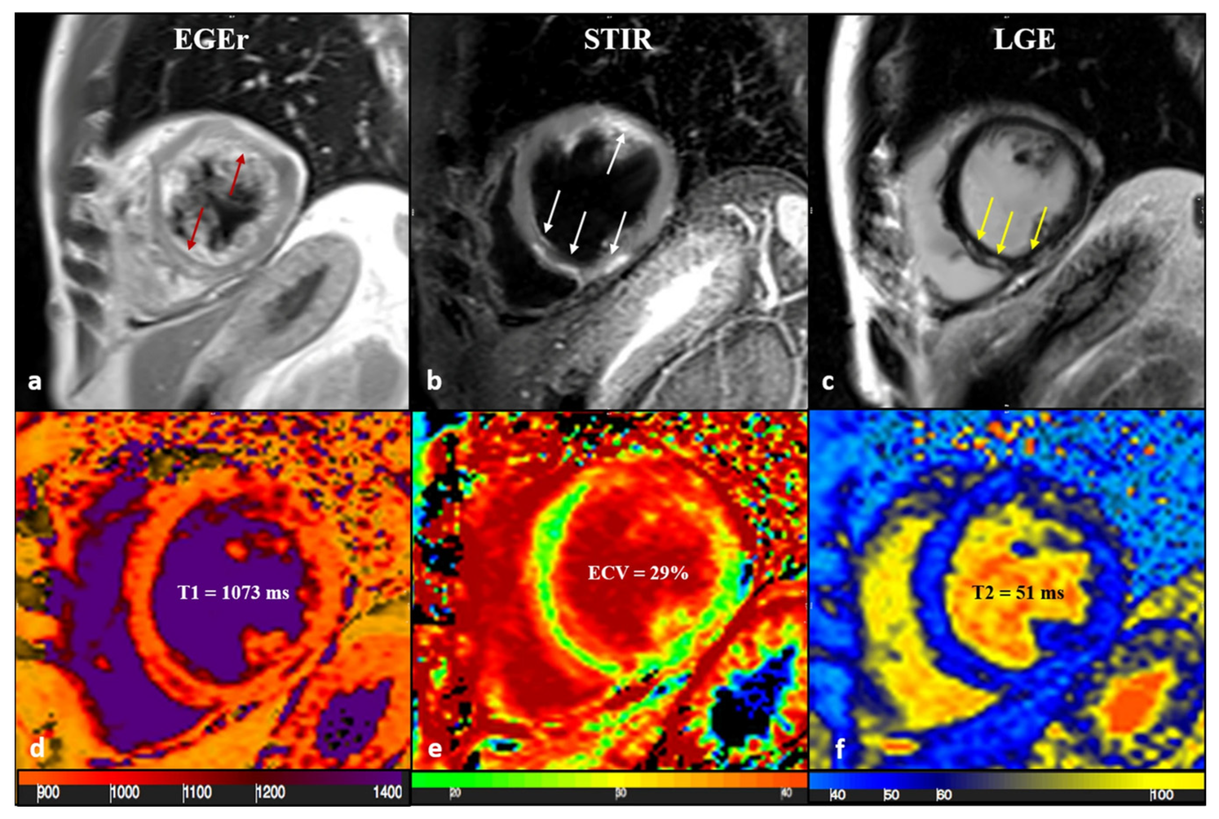 Biomedicines 14 00588 g005 Biomedicines 14 00588 g005