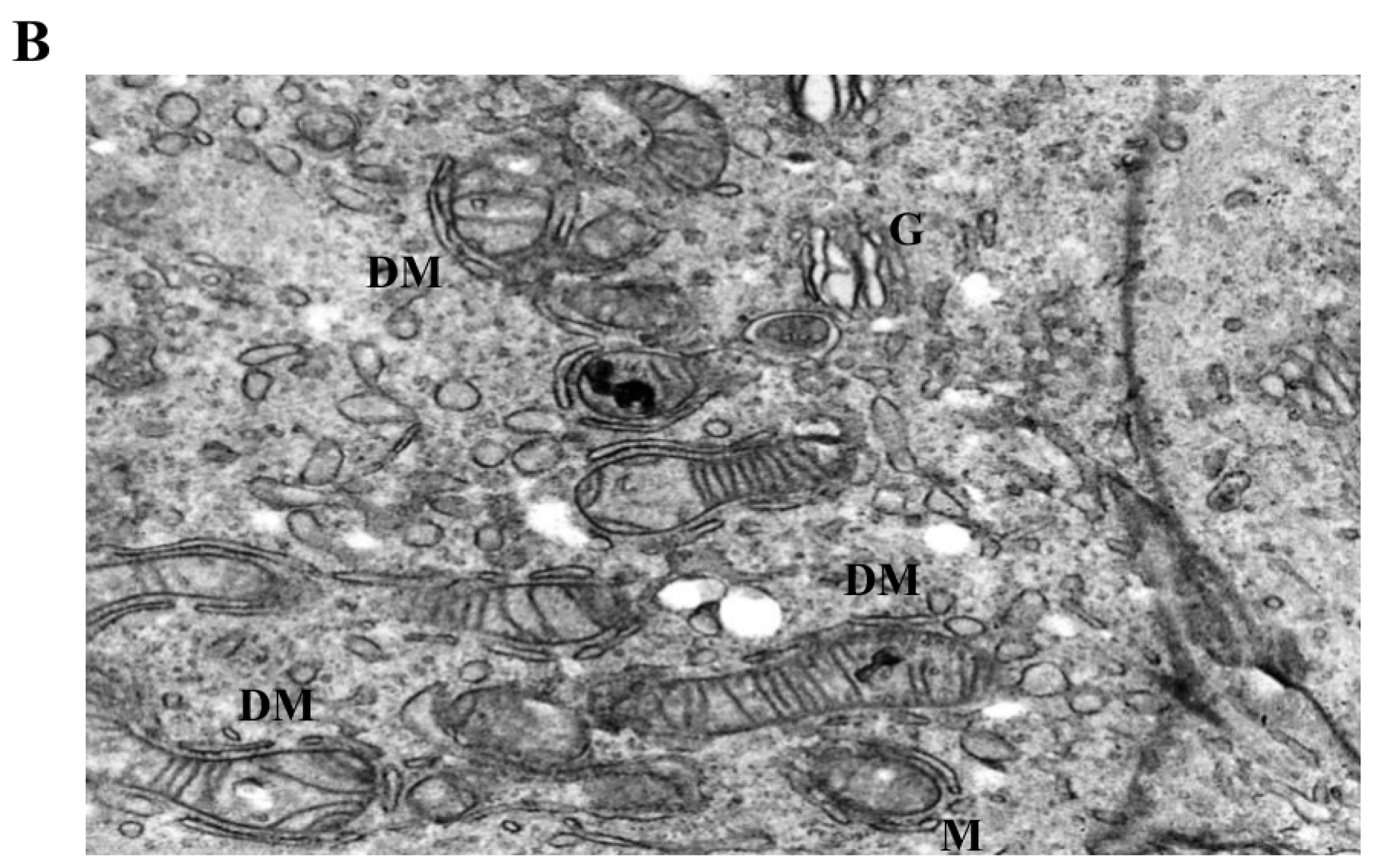 Biomedicines 14 00655 g005b