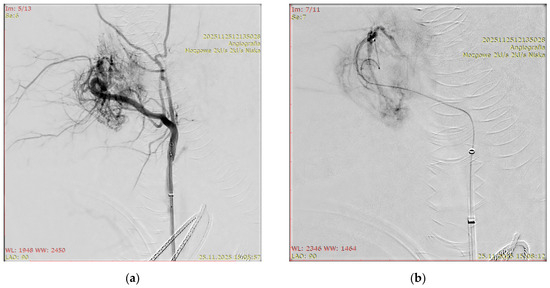 Biomedicines 14 01251 g004a Biomedicines 14 01251 g004a