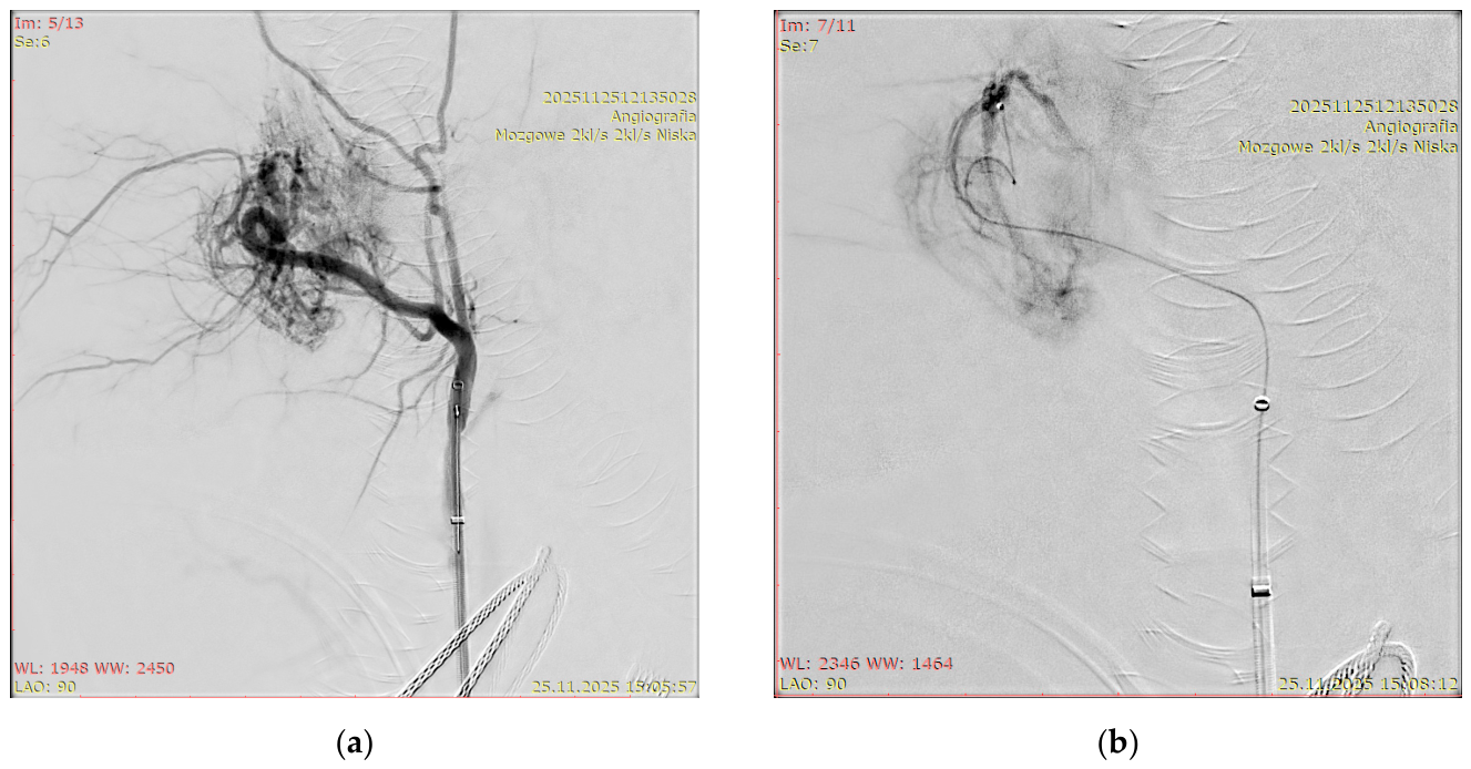 Biomedicines 14 01251 g004a Biomedicines 14 01251 g004a