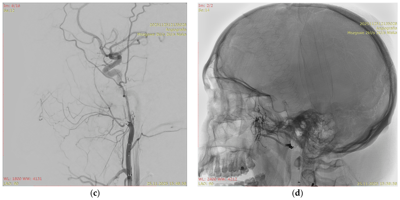 Biomedicines 14 01251 g004b Biomedicines 14 01251 g004b