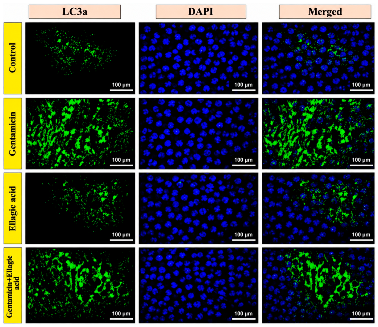 Biomedicines 14 01385 g008 Biomedicines 14 01385 g008