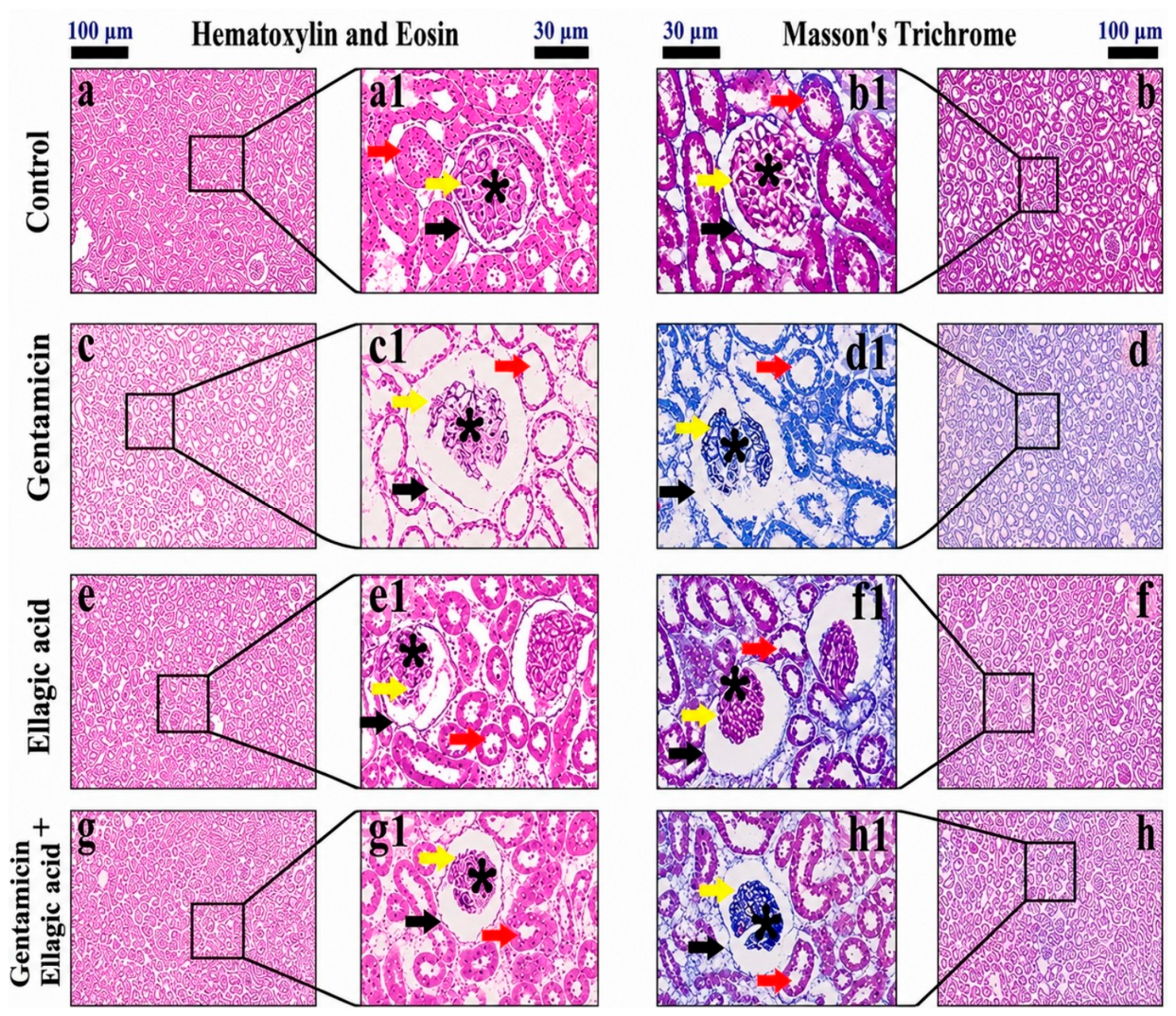 Biomedicines 14 01385 g010 Biomedicines 14 01385 g010