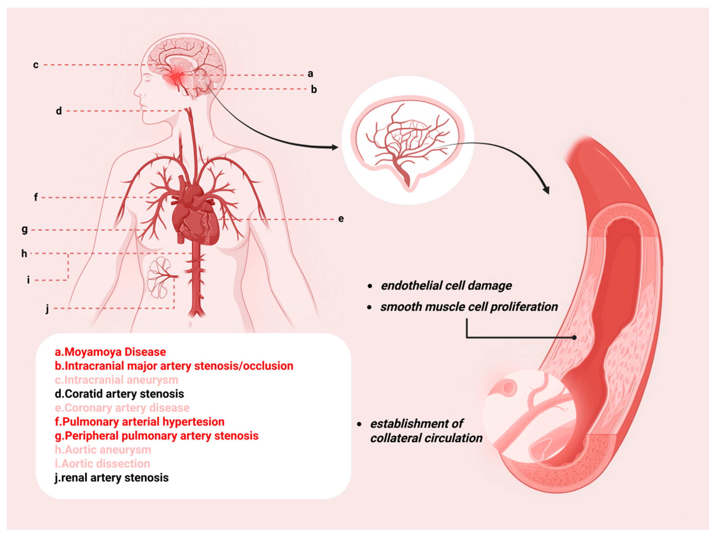 Biomedicines 14 01748 g002 Biomedicines 14 01748 g002