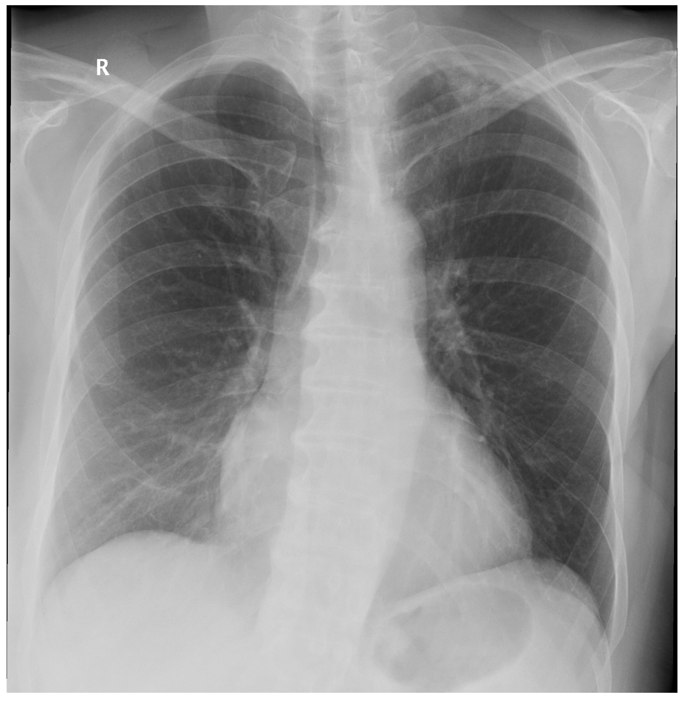 Biomedinformatics 03 00006 g0a1 Biomedinformatics 03 00006 g0a1