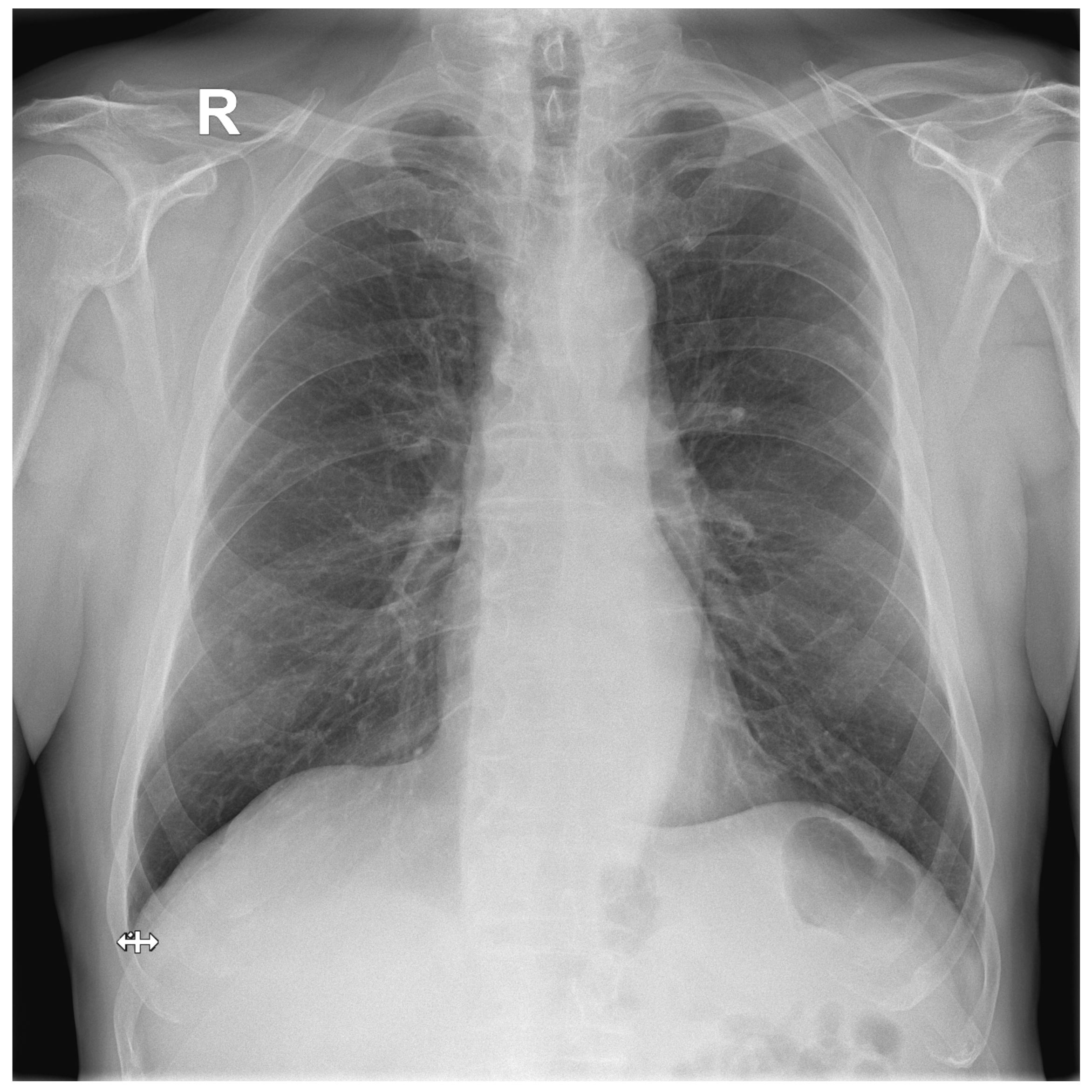 Biomedinformatics 03 00006 g0a3 Biomedinformatics 03 00006 g0a3