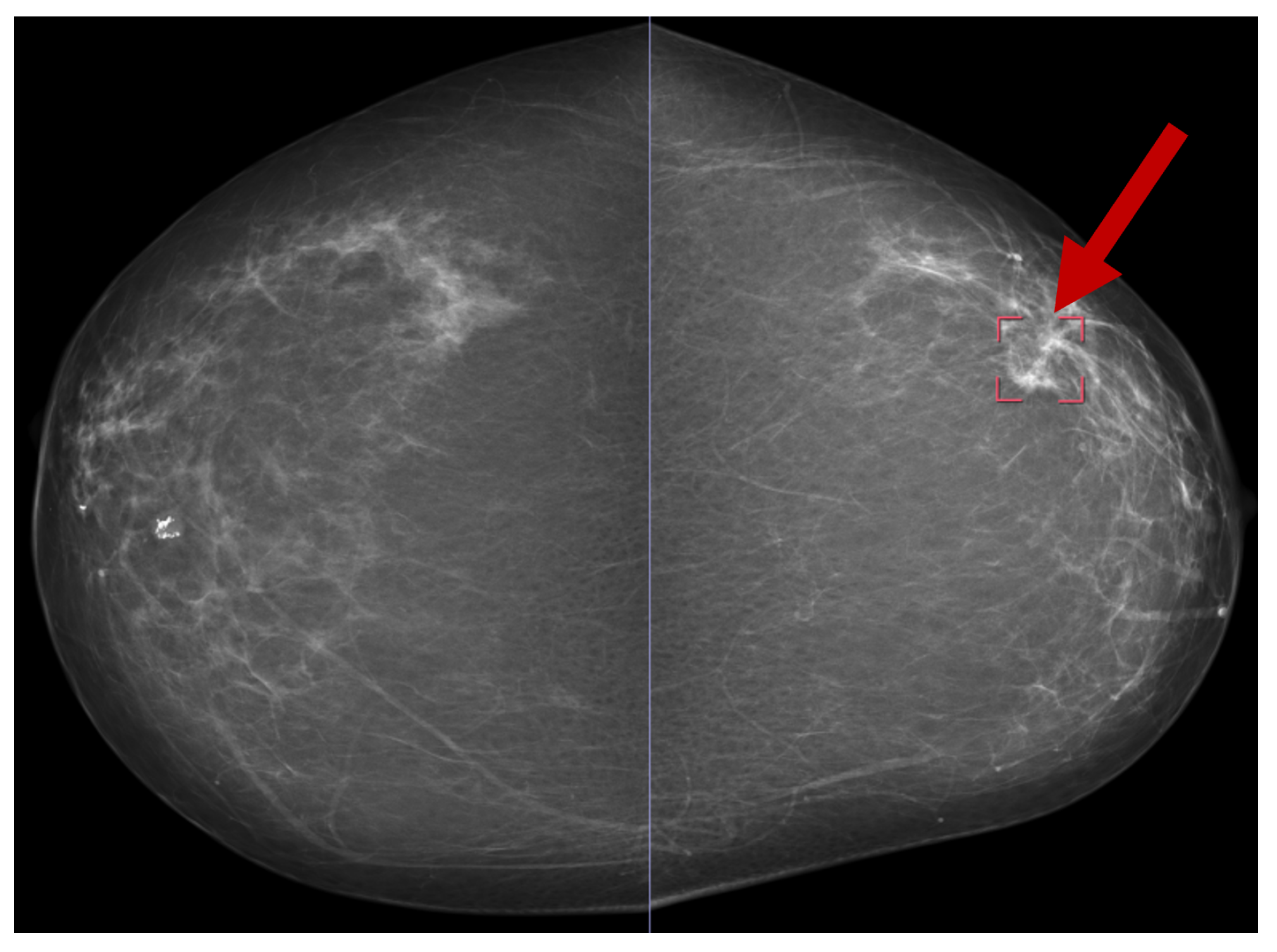 Biomedinformatics 05 00046 g013 Biomedinformatics 05 00046 g013