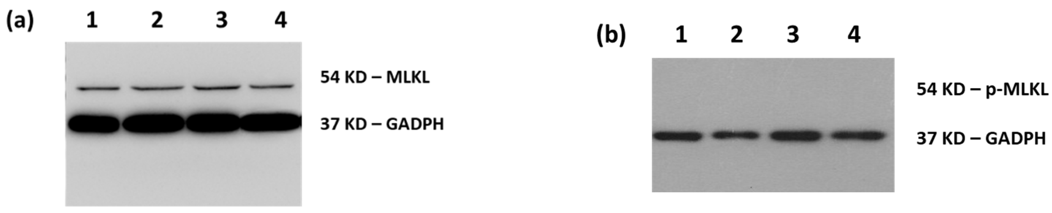 Biomimetics 06 00010 g005 Biomimetics 06 00010 g005