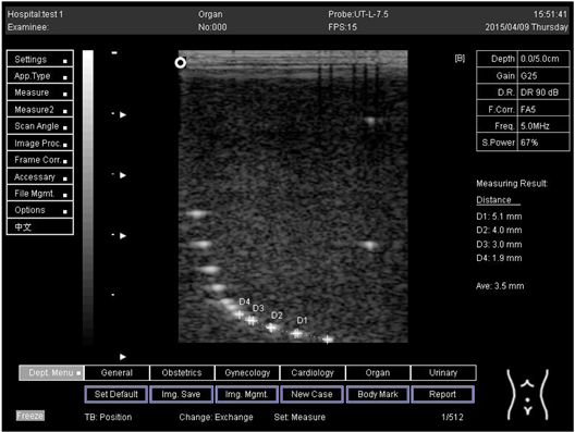 Biomimetics 07 00130 i004