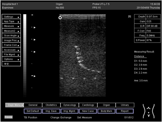 Biomimetics 07 00130 i007