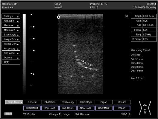 Biomimetics 07 00130 i008