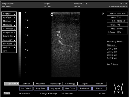 Biomimetics 07 00130 i009