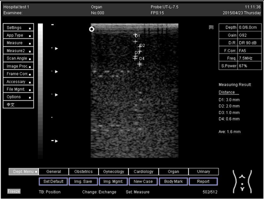 Biomimetics 07 00130 i013