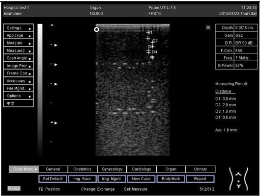 Biomimetics 07 00130 i015