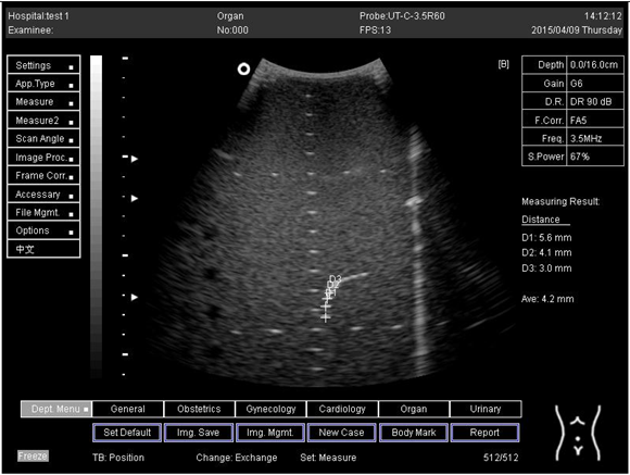 Biomimetics 07 00130 i025