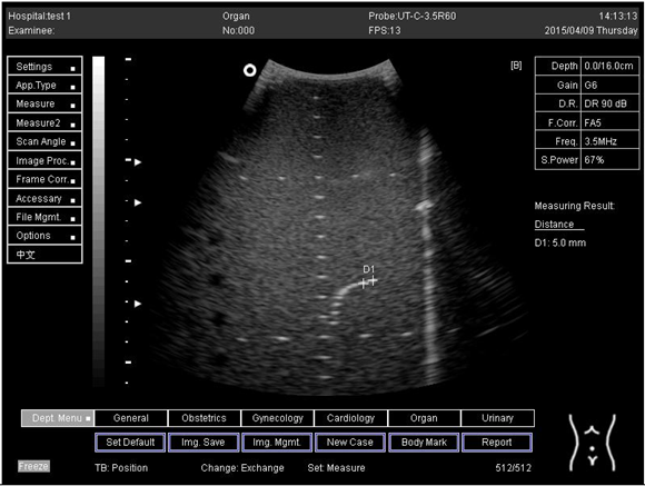 Biomimetics 07 00130 i026