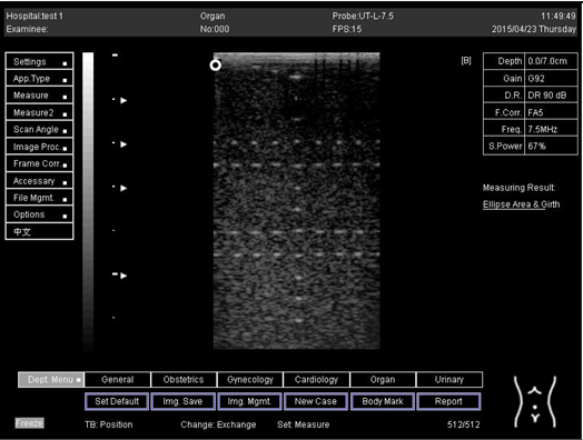 Biomimetics 07 00130 i039