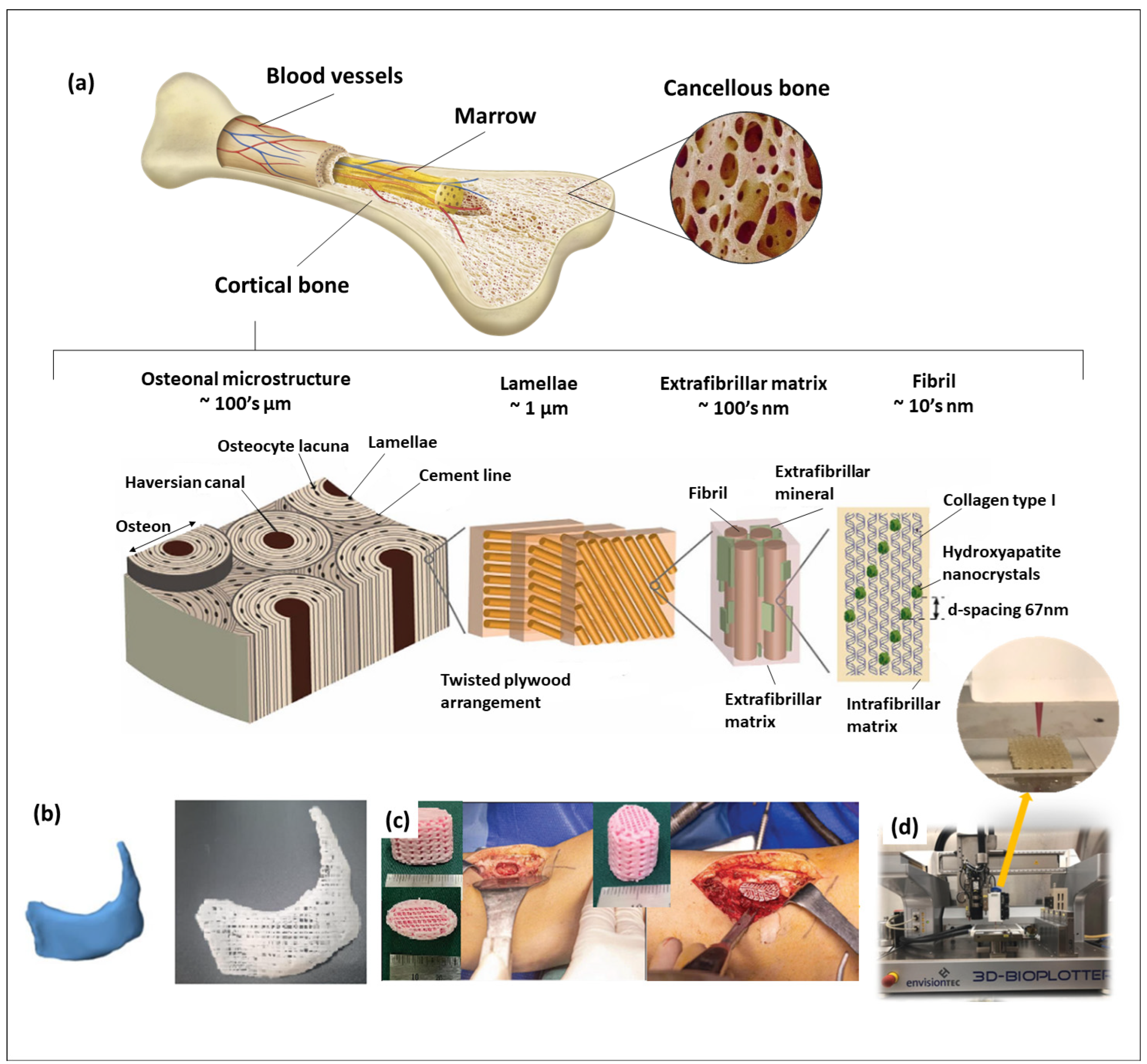 Calcium Phosphate Biomaterials for 3D Bioprinting in Bone Tissue ...