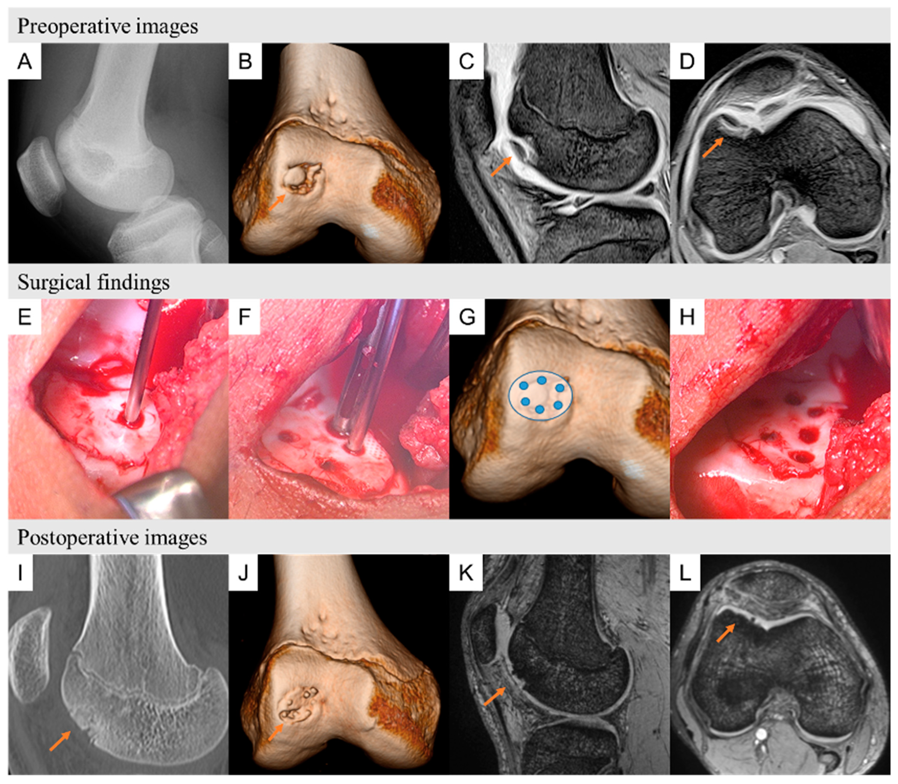 Biomimetics 09 00232 g005