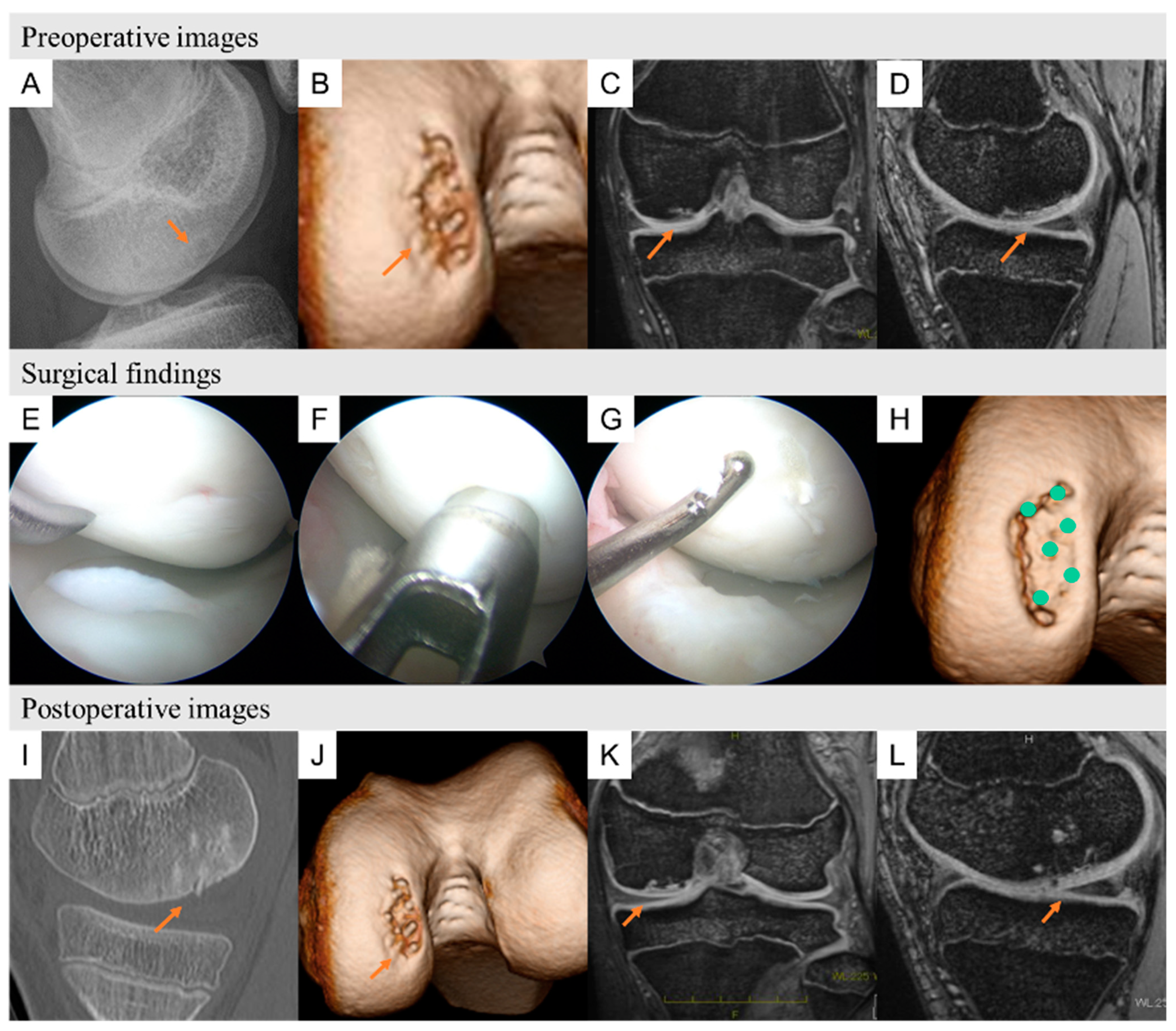 Biomimetics 09 00232 g006