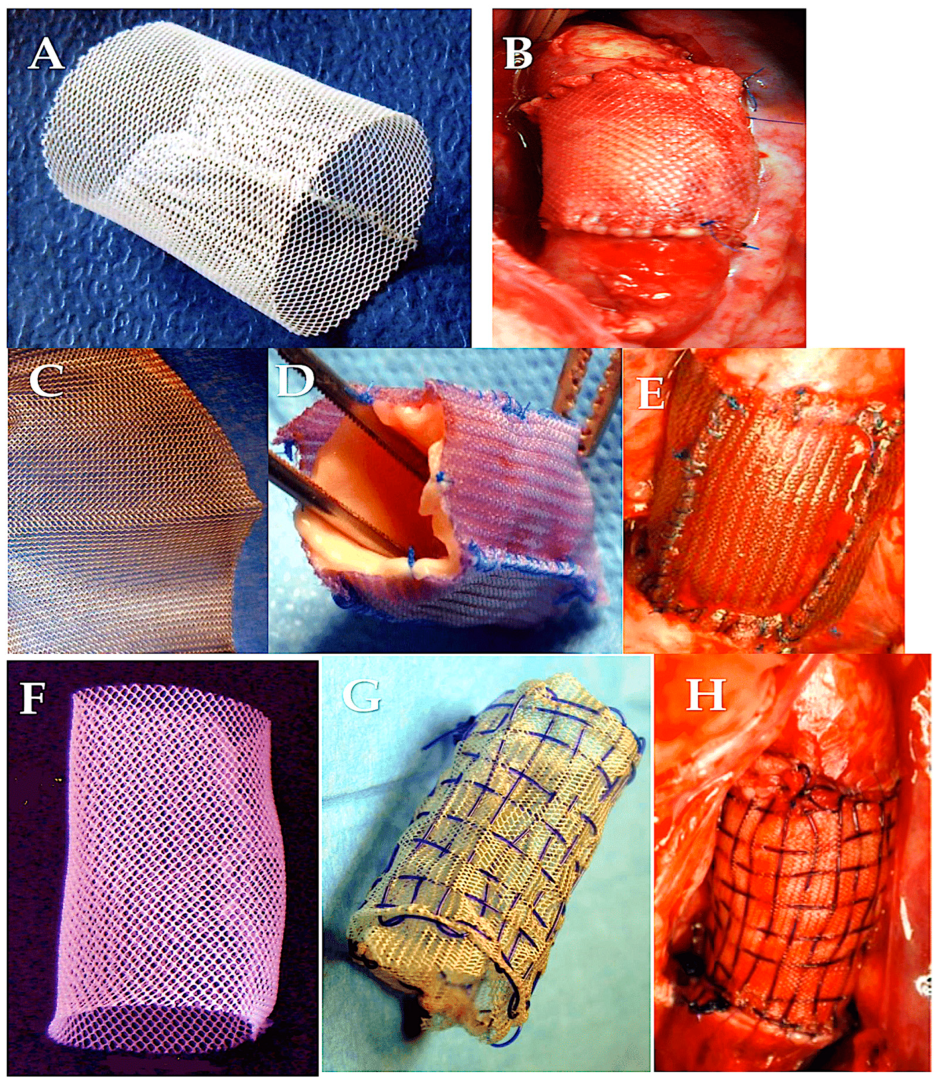 Biomimetics 09 00674 g006 Biomimetics 09 00674 g006