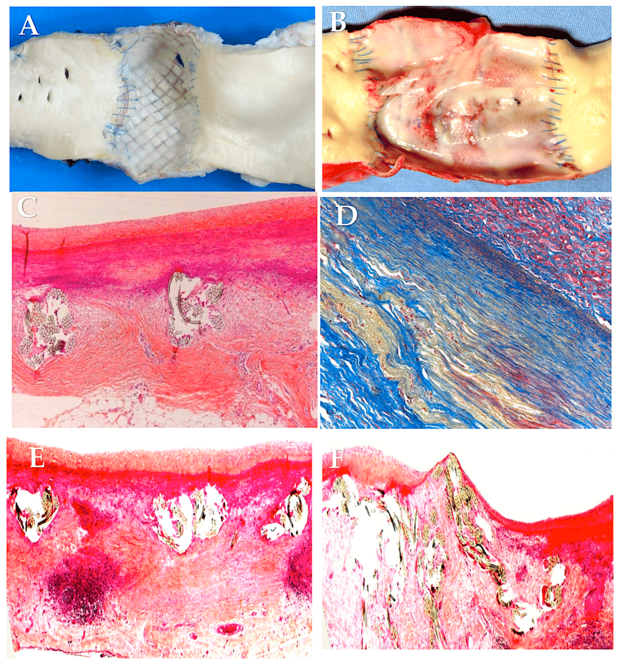 Biomimetics 09 00674 g008 Biomimetics 09 00674 g008