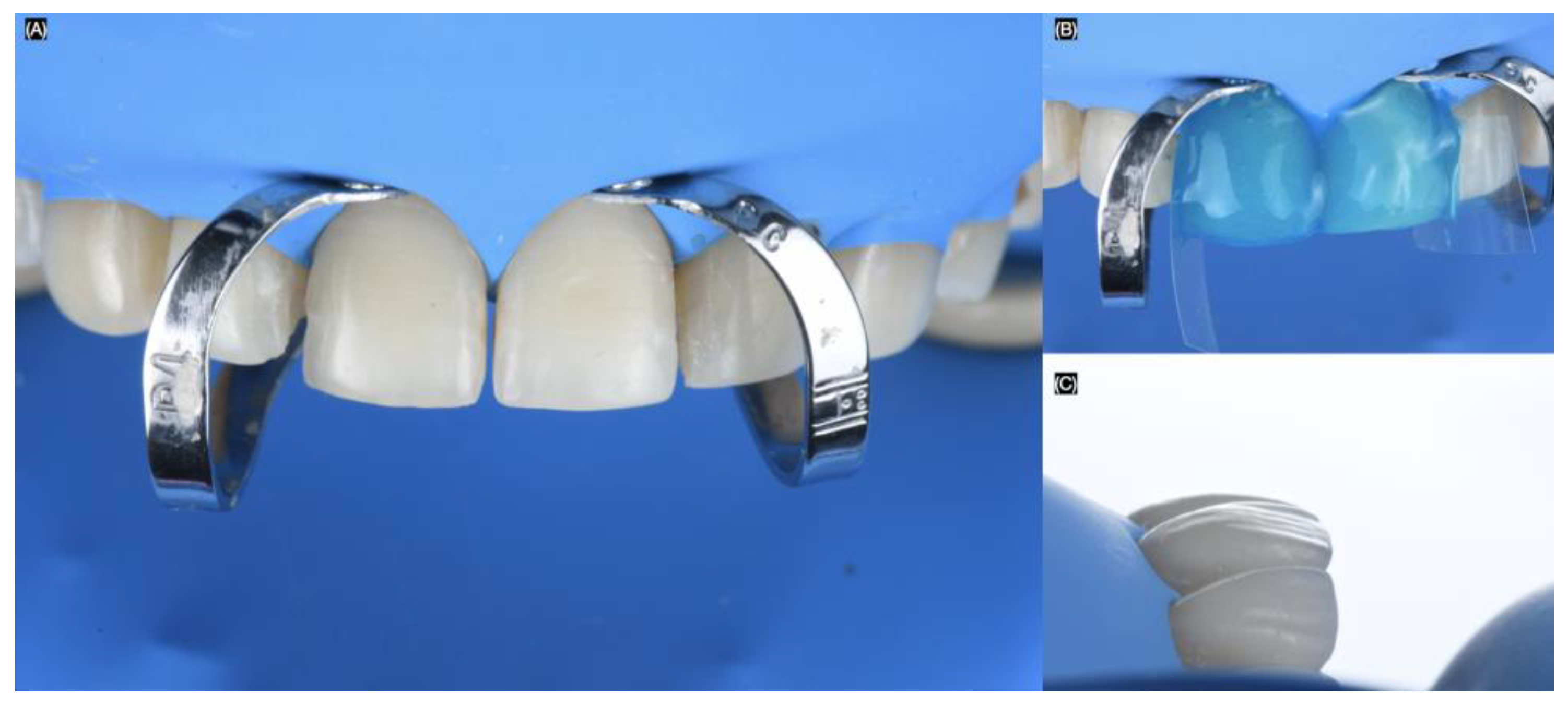 Biomimetics 10 00188 g008
