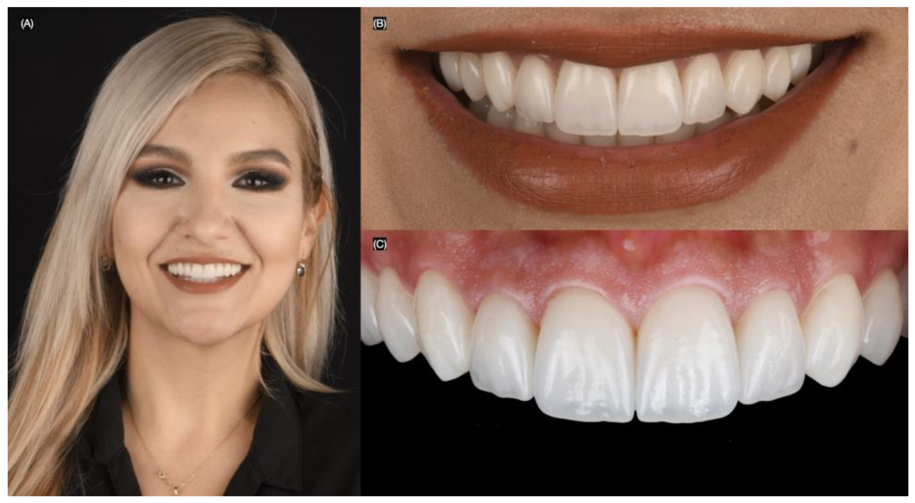 Biomimetics 10 00188 g009