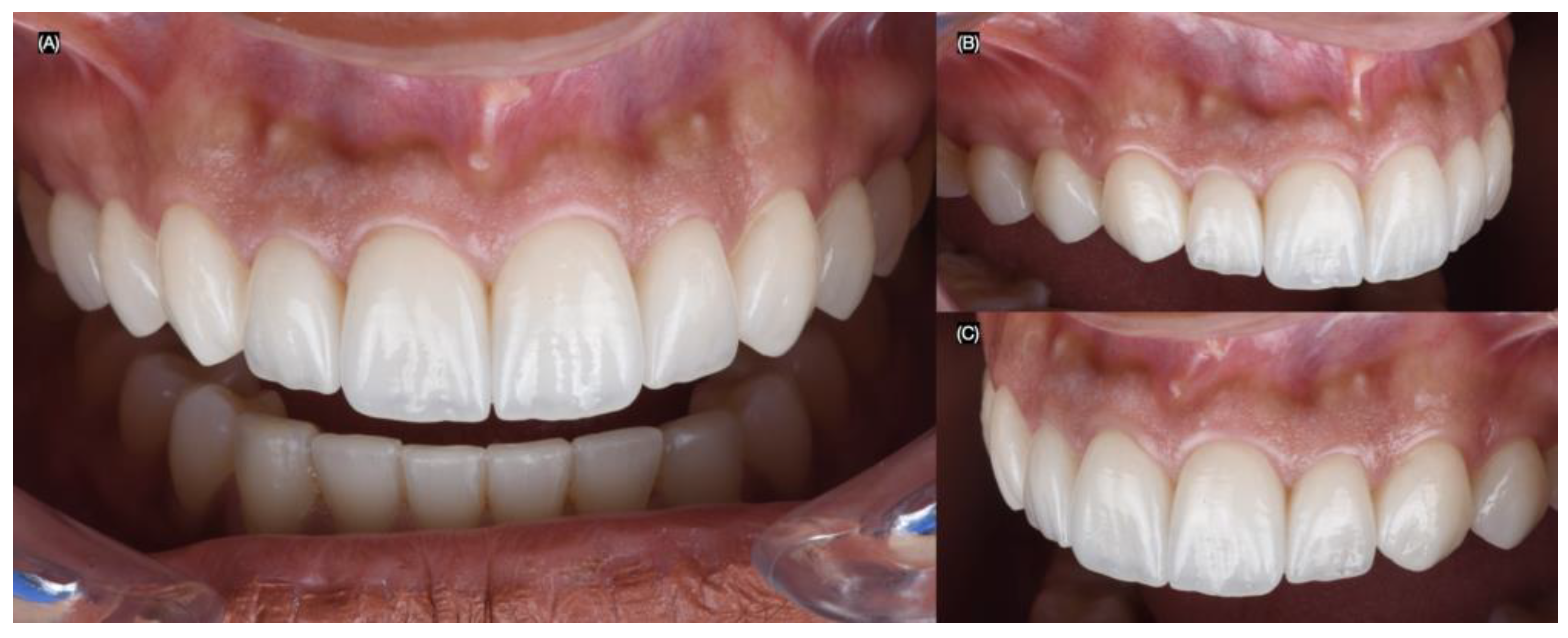 Biomimetics 10 00188 g010