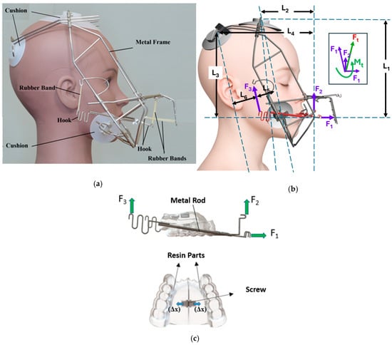 (a) Schematic of RAMPA worn by a manikin; (b) diagram of external forces applied on RAMPA; (c) gHu-1 intraoral appliance from the top view.