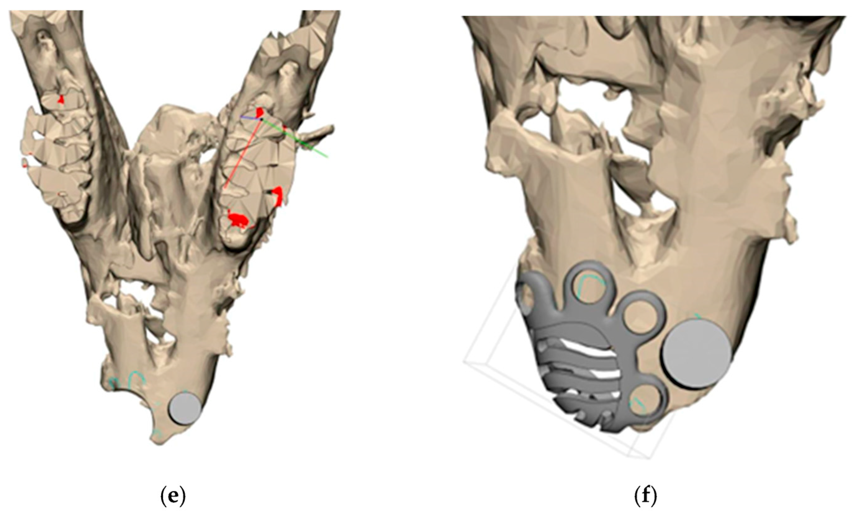 Biomimetics 11 00091 g003b Biomimetics 11 00091 g003b