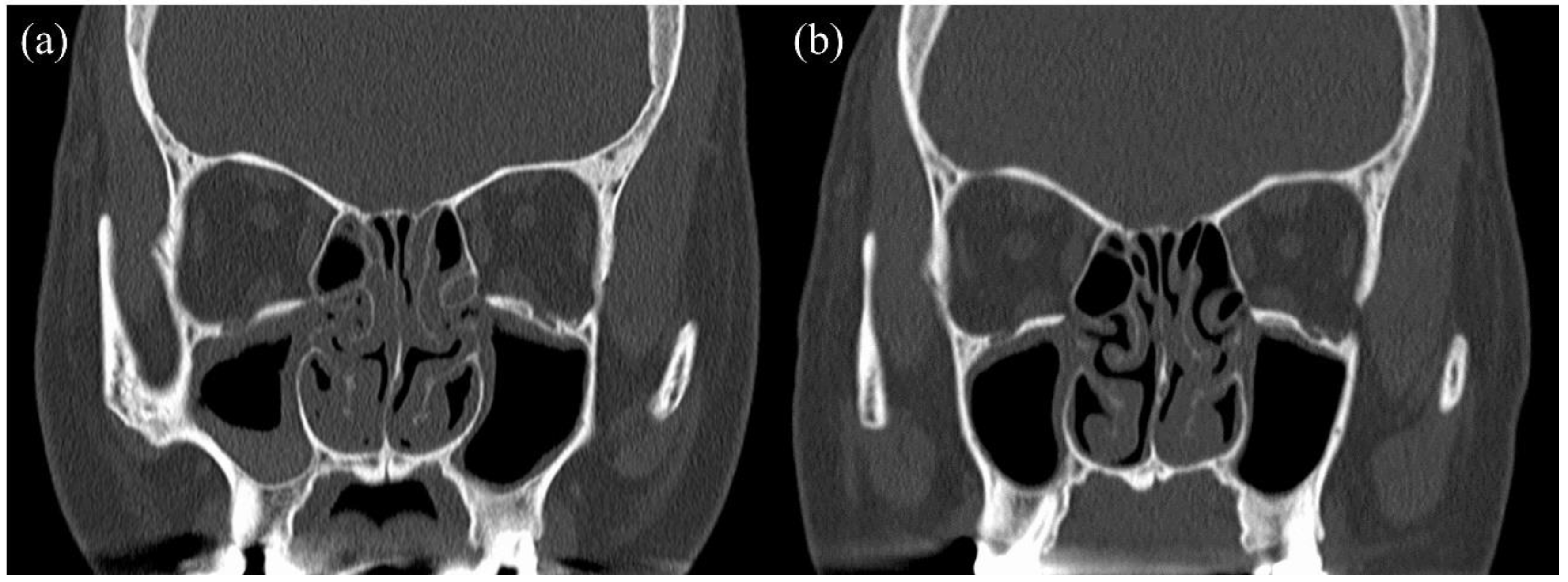 Biomolecules 12 00522 g002