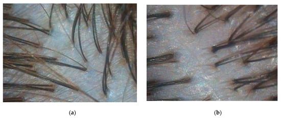 Biomolecules 13 00699 g0a1a