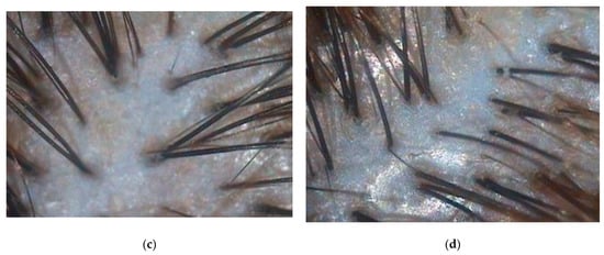 Biomolecules 13 00699 g0a1b