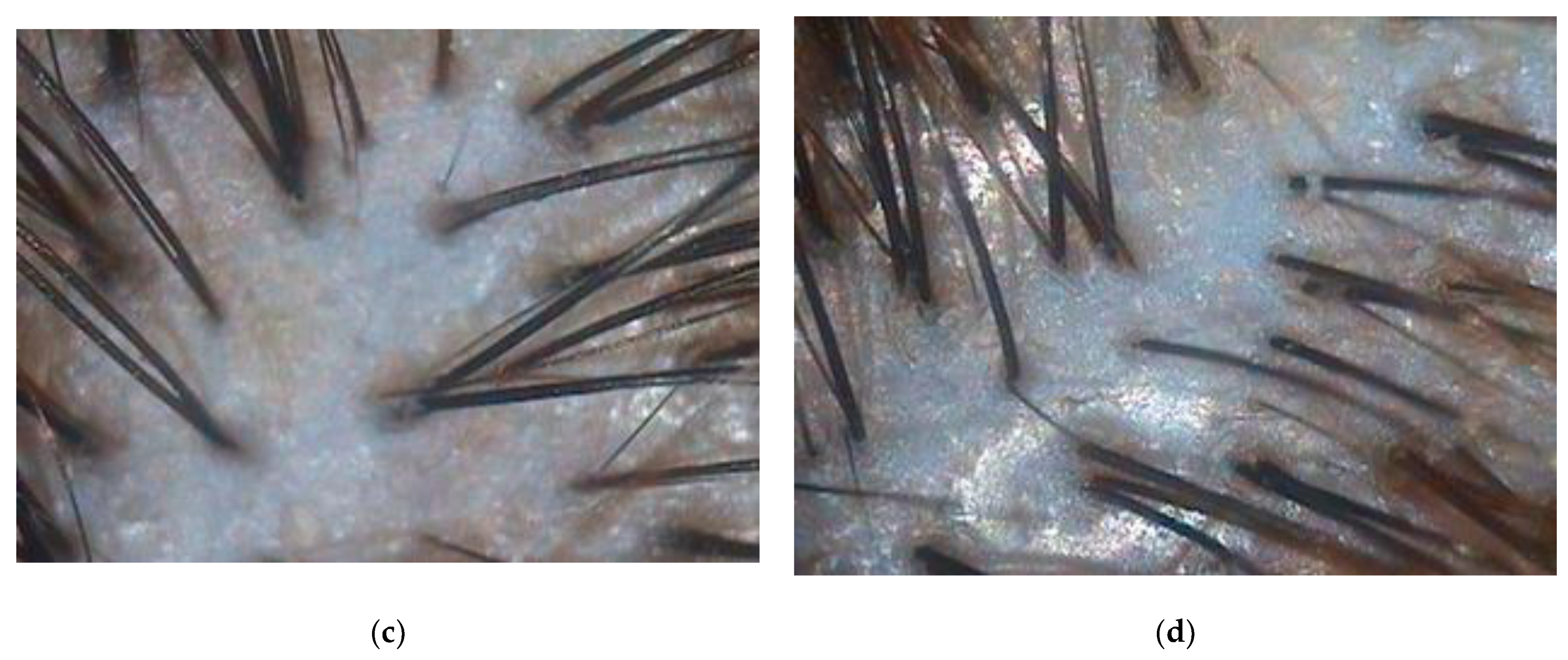 Biomolecules 13 00699 g0a1b