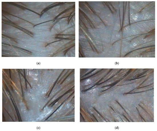 Biomolecules 13 00699 g0a2