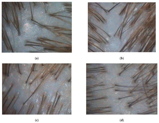 Biomolecules 13 00699 g0a3