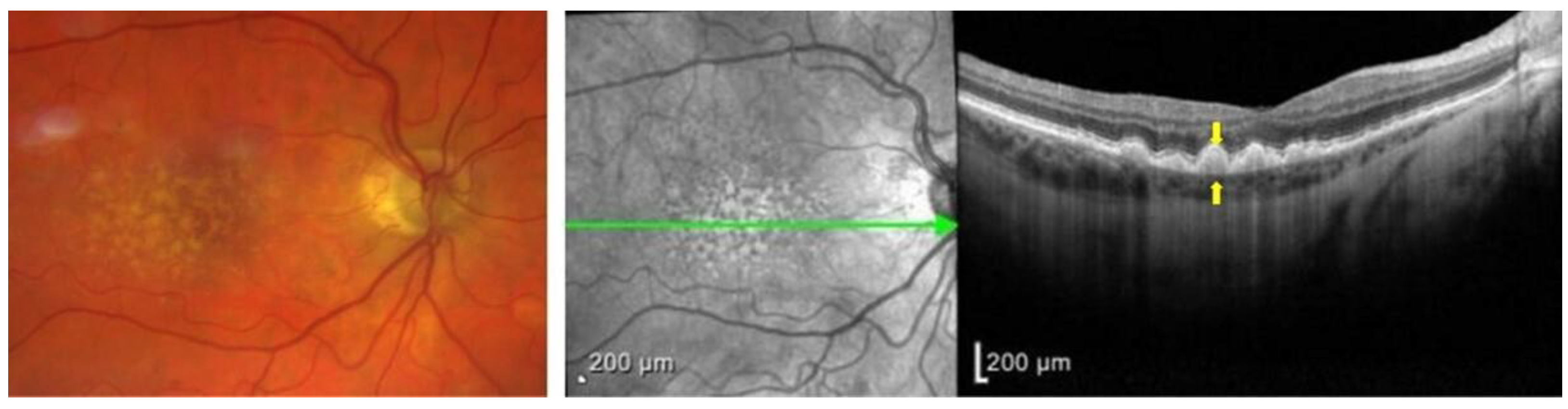 Biomolecules 13 00832 g002