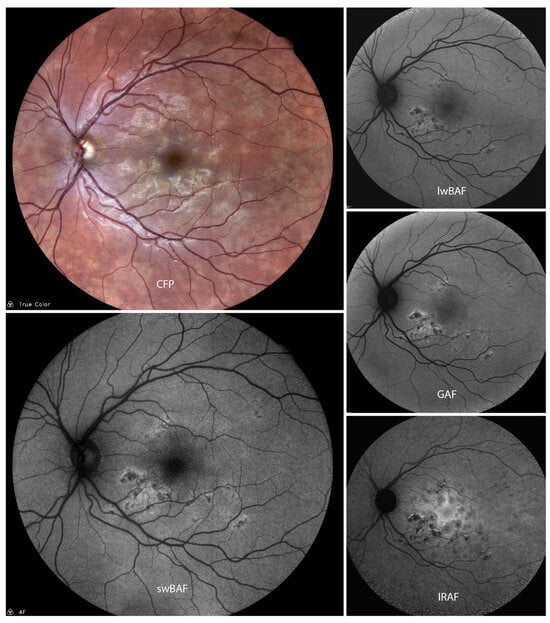 Biomolecules 14 00515 g001