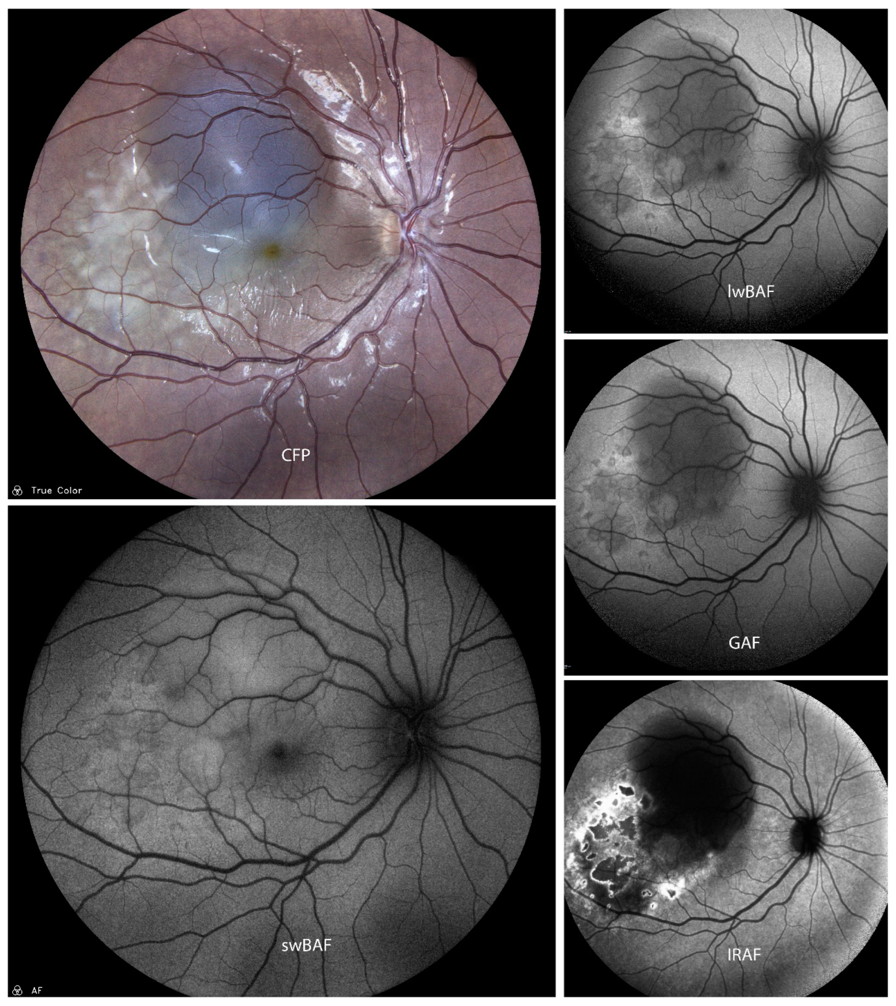 Biomolecules 14 00515 g006