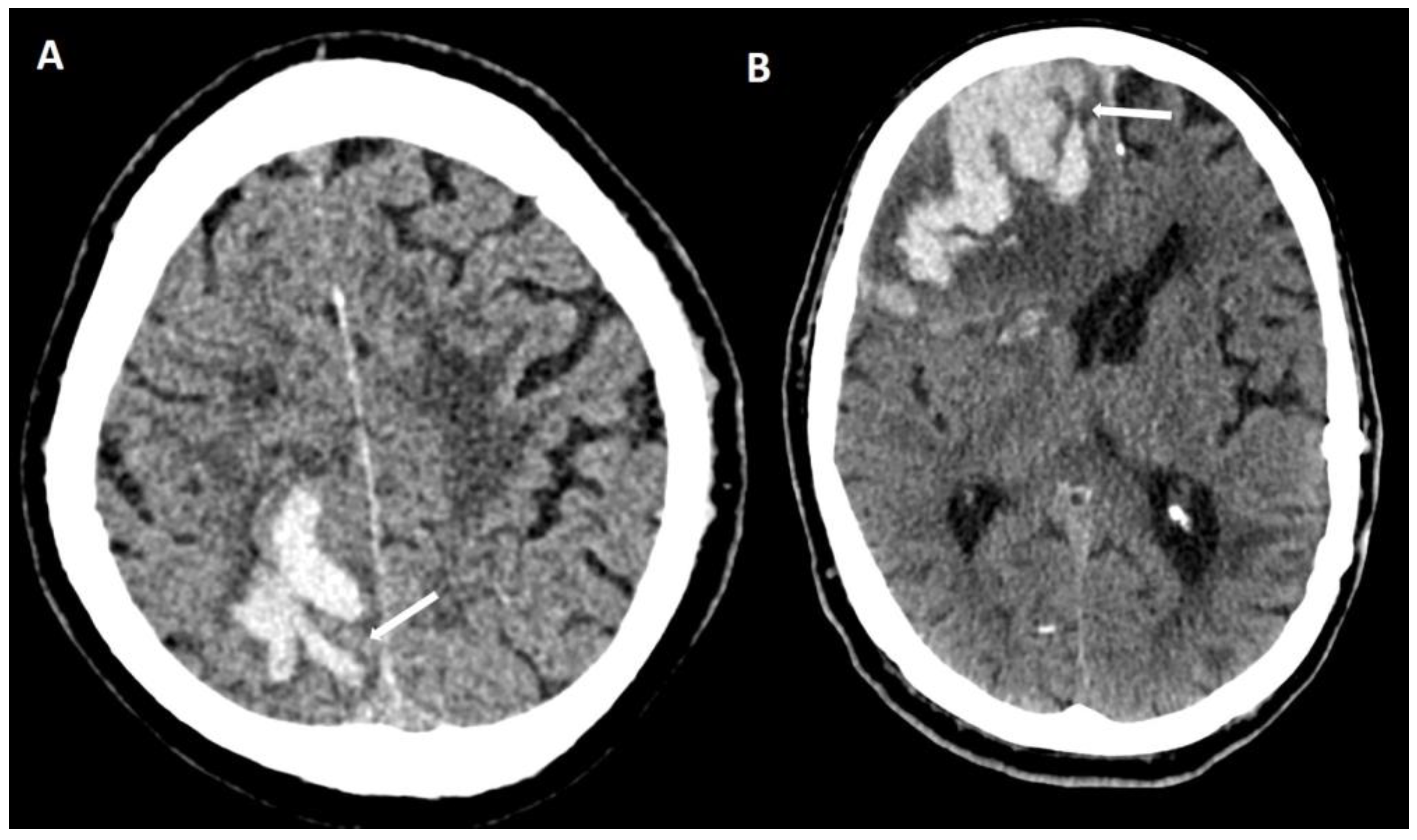 Biomolecules 14 01459 g008