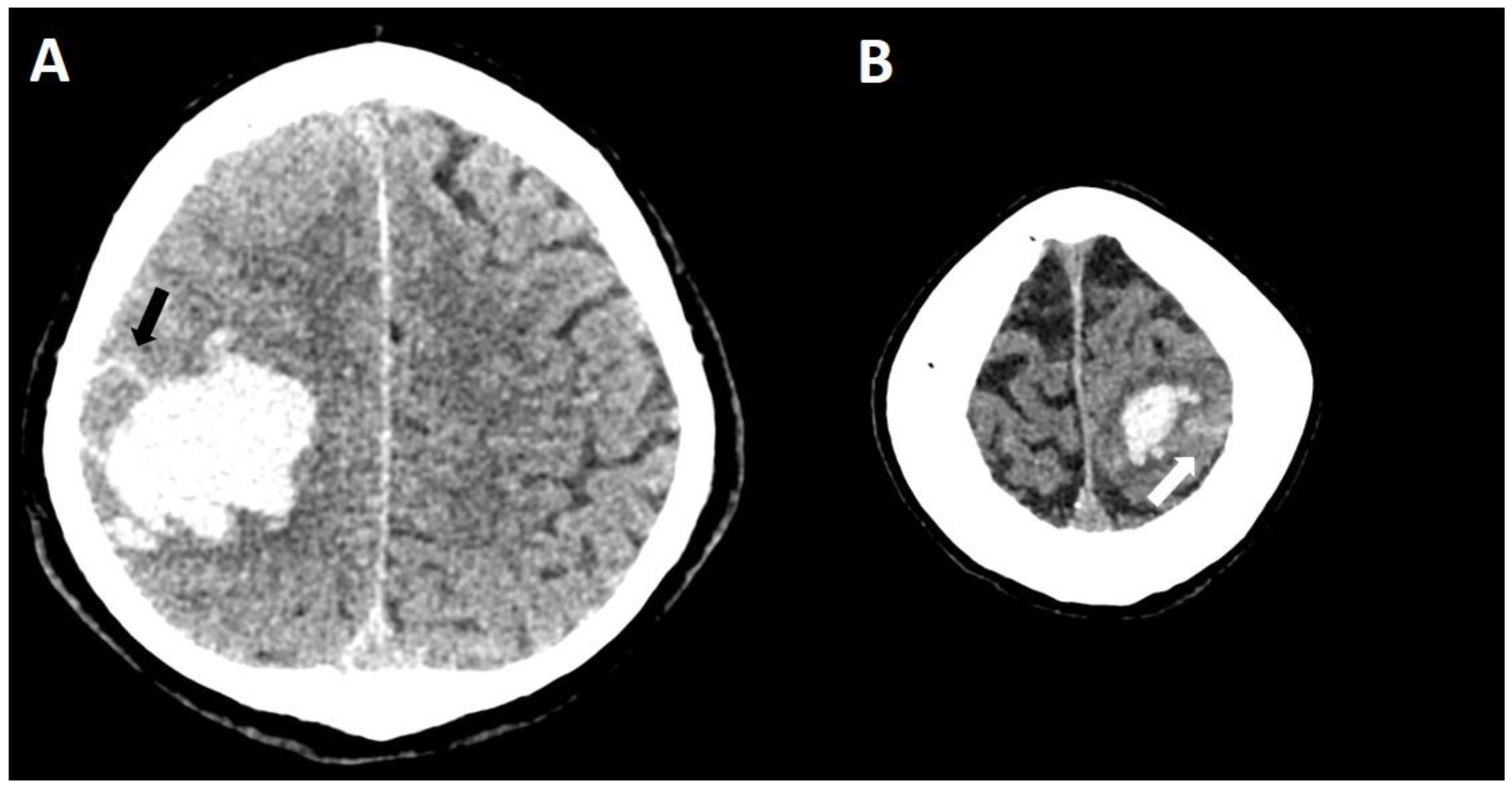 Biomolecules 14 01459 g011