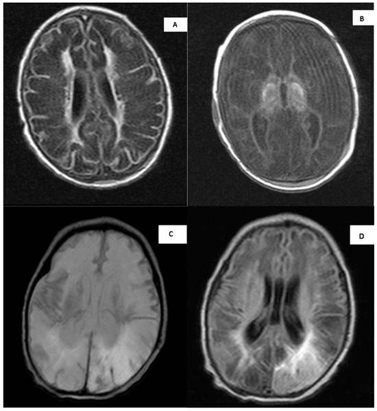 Biomolecules 15 00427 g0a1