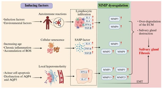 Multi-driver crosstalk in Sjögren’s syndrome SG fibrogenesis. This schematic illustrates the synergistic mechanisms driving SG fibrosis in SS. Autoimmune activation, cellular senescence, and hyperosmolarity collectively stimulate inflammatory cytokine production. These cytokines induce MMP dysregulation, leading to excessive ECM degradation and glandular architecture disruption. Concurrently, chronic inflammation promotes EMT and initiates aberrant scar-repair processes. The cycle culminates in progressive fibrotic tissue deposition, ultimately resulting in irreversible gland dysfunction.