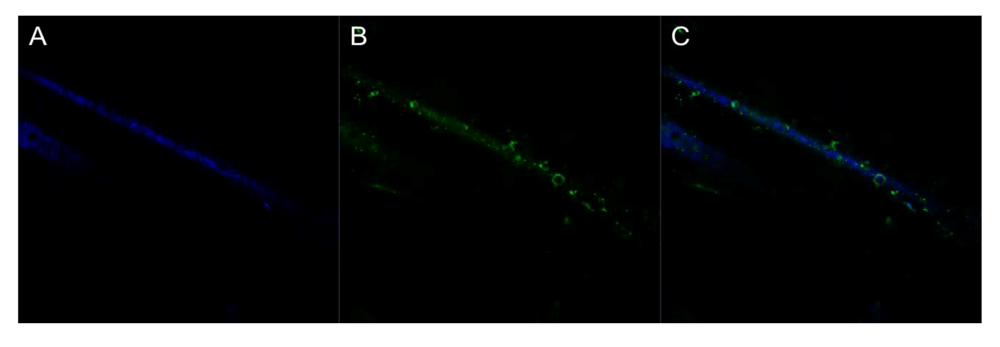 Biosensors 02 00465 g005 1024