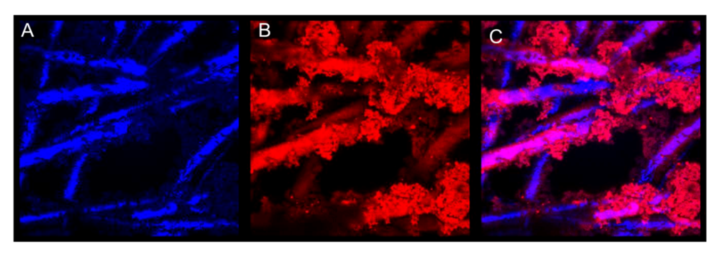 Biosensors 02 00465 g006 1024