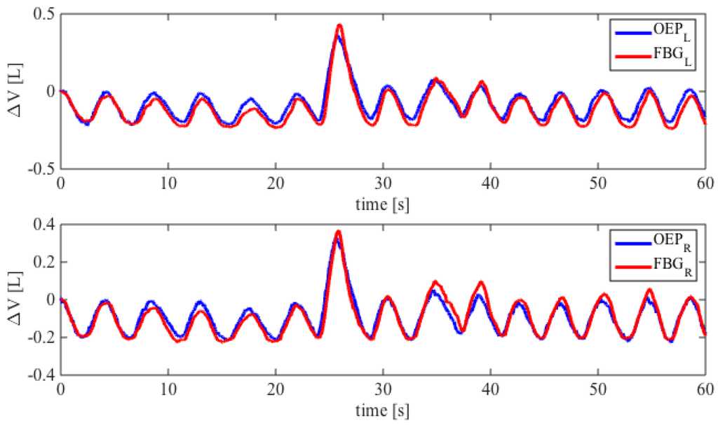 Biosensors 05 00602 g006 1024